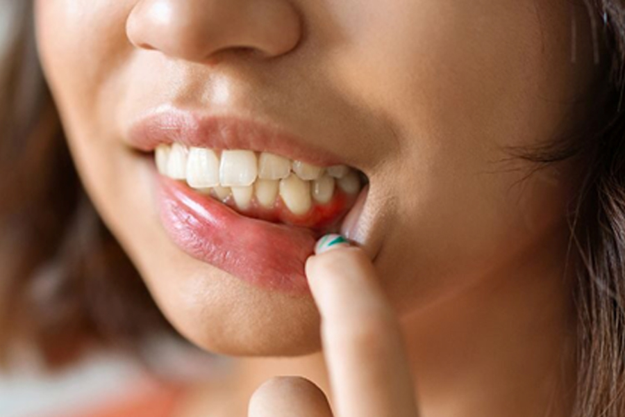 Periodontics and Gum Care