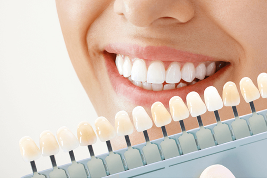 Cosmetic Dentistry & Smile Designing
