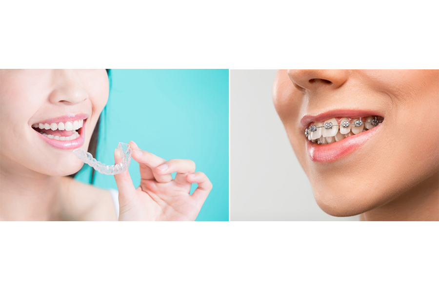 Orthodontics & Braces